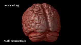 A koponya, az agy felépítése, agyi CT scan video (ujmedicina, biologika)