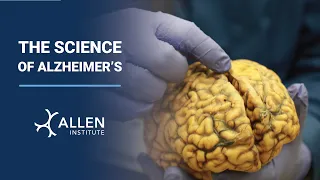 The Science of Alzheimer's: Brain Awareness Week 2023