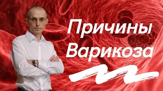 Причины варикоза. Какие факторы влияют на его развитие.