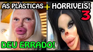 🔴 As PIORES Plásticas do Mundo! As Plásticas que deram Errado PARTE 3