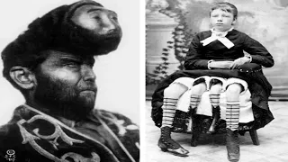 20 Circus Freaks That Actually Existed!