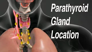 Parathyroid Gland Location: Common Locations of Missed Parathyroid Adenomas