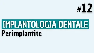 Implantologia Dentale - Perimplantite