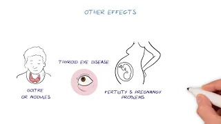 Thyroid Disease HealthSketch