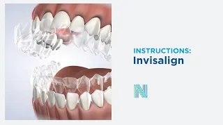 Invisalign® Instructions in Fresno CA | Nalchajian Orthodontics