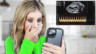 Rebecca Hears Her Baby's Heartbeat for the First Time