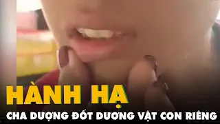 Nghi án cha dượng đốt dương vật, hành hạ con riêng của vợ ở An Giang