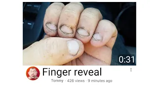 I Searched Up "fingers" on YouTube, here’s what I found
