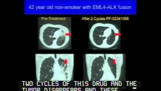 Interrogating Circulating Tumor Cells to Direct Targeted Cancer Therapies