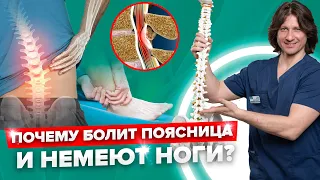 ОТ боли в пояснице ДО паралича ног! Что такое СТЕНОЗ позвоночника и как с этим бороться?