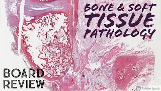 Bone & Soft Tissue Pathology Board Review: 20 Classic Cases (McGill pathology residents)