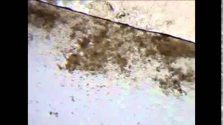 Flukes parasites from a koi scape