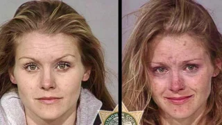 Faces Of Meth-Before And After