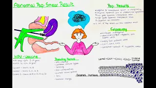 Abnormal PAP Smear Result? HPV Infection? Cervical Dysplasia - Results, Biopsy, Conization, Vaccines