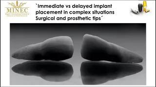 Immediate vs Delayed implant placement in complex situations: Surgical and Prosthetic tips
