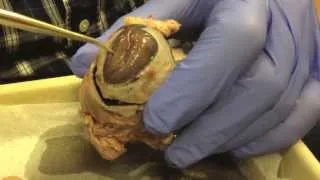 Eyeball dissection Eye anatomy