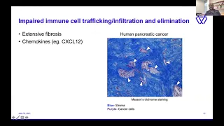 Unleashing the Antitumor Immune Response