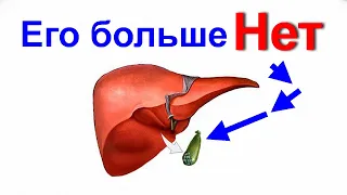 Что нельзя ни в коем случае есть и как питаться после удаления ЖЕЛЧНОГО ПУЗЫРЯ? Кушайте по новому