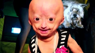 Unusual People With genetic mutations | REAL people with shocking genetic mutations. MIND-BLOWING