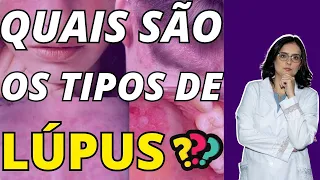 Tipos de lúpus I Quais são os tipos de lúpus? I Leo&carol Ensina