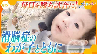 治療法のない難病『滑脳症』を患うわが子… 覚悟はある。だけど信じる。「ミオナは今のところ、毎日勝ち試合やな！」共に戦う両親の日々【かんさい情報ネットten.特集/カラフル】