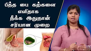 பித்தப்பை கற்களுக்கு எளிய தீர்வு | Gall Bladder Stone | Cholelithiasis | Dr.B. Yoga vidhya