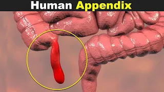 The Human Appendix | Its Diseases And Treatment (Urdu/Hindi)