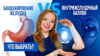 ЧТО ВЫБРАТЬ? Бандажирование желудка или внутрижелудочный баллон ?