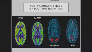 The Role of EMDR in Managing Chronic Pain and SUD