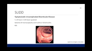 Abdominal Pain and Diverticulosis: SUDD, SCAD, or Smoldering Diverticulitis?