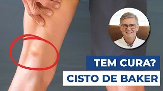 O que é Cisto de Baker ou Cisto na Poplítea? (Sintomas, Diagnósticos e Tratamentos)