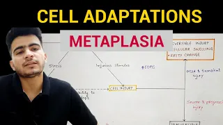 Metaplasia | Cell Adaptations (3/3) | General Pathology | EOMS