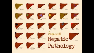 Hepatic Pathology - Name that Pathology!!