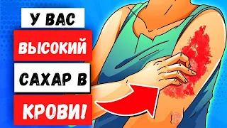 Тревожные Признаки Того, Что У Вас Высокий Уровень Сахара В Крови.