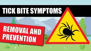 Tick Bite Symptoms And Preventing Lyme Disease [Survival Tips For You And Your Dog]