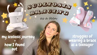 Challenges of Wearing a Scoliosis Brace as a Teenager: My Scoliosis Journey