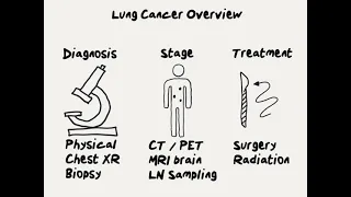 Doctor Explains What to Expect with New Lung Cancer Diagnosis