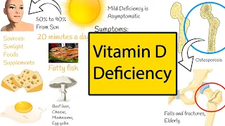 Vitamin D Function and deficiency.  Why is Vitamin D so important for you?