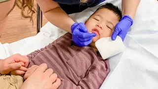 Our Toddler Bit Through His Lip! 😢