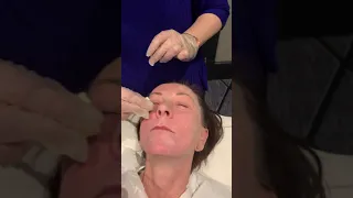 Dr Zein Obagi three step chemical peel