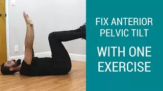 How to fix Tight Hips with one Anterior Pelvic Tilt correction exercise - REAL case study