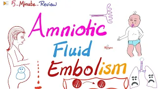 Amniotic Fluid Embolism | ObGyn Pathology Lectures | 5-Minute-Review Series