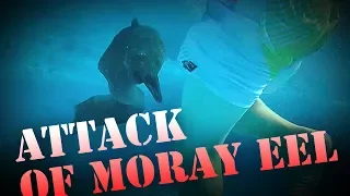 Attack of MorayEel / Нападение мурены на человека