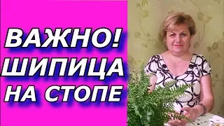 ШИПИЦА на стопе !!!Бородавки и папиломы под вопросом , но возможно!!!