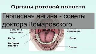 Герпесная ангина - советы доктора Комаровского