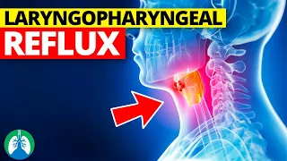 Laryngopharyngeal Reflux (Medical Definition) | Quick Explainer Video