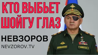 Окопная война. Где путину взять снаряды? Потери под Авдеевкой. Одноглазый Шойгу.Башкирская революция