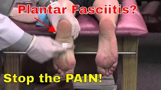 Plantar Fasciitis: Fix it Forever