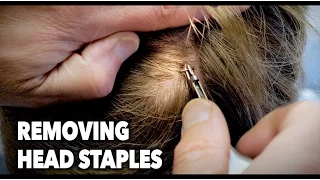 Removing HEAD STAPLES! (Ouch) | Dr. Paul