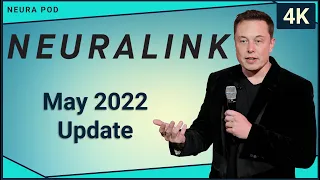 Neuralink Update – May 2022 (Part 1)